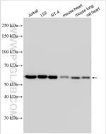 CCDC47 Antibody in Western Blot (WB)
