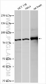 ACP6 Antibody in Western Blot (WB)
