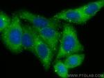 CD2AP Antibody in Immunocytochemistry (ICC/IF)