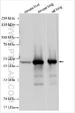 CD2AP Antibody in Western Blot (WB)