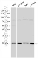 C2orf69 Antibody in Western Blot (WB)