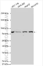 SPATA5 Antibody in Western Blot (WB)