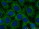 LRRC45 Antibody in Immunocytochemistry (ICC/IF)