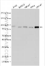 LRRC45 Antibody in Western Blot (WB)