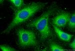 SBK2 Antibody in Immunocytochemistry (ICC/IF)