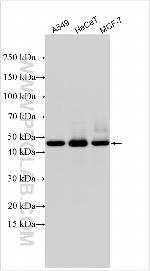 MBOAT4 Antibody in Western Blot (WB)