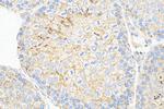 Nectin-2/CD112 Antibody in Immunohistochemistry (Paraffin) (IHC (P))