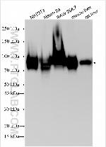 Nectin-2/CD112 Antibody in Western Blot (WB)