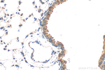 OSBPL6 Antibody in Immunohistochemistry (Paraffin) (IHC (P))