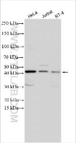 TNRC18 Antibody in Western Blot (WB)