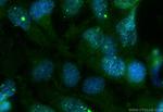 TOM1L2 Antibody in Immunocytochemistry (ICC/IF)