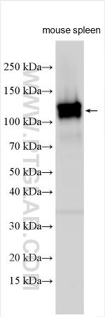 CD36 Antibody in Western Blot (WB)