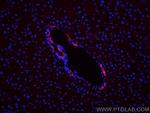 EPCAM/CD326 Antibody in Immunohistochemistry (Paraffin) (IHC (P))