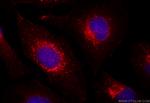 DNAJC5 Antibody in Immunocytochemistry (ICC/IF)