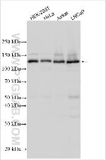 DNAJC5 Antibody in Western Blot (WB)
