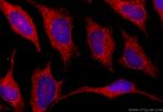 SLPI Antibody in Immunocytochemistry (ICC/IF)