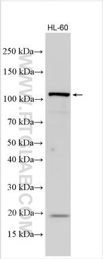 ABL1 Antibody in Western Blot (WB)