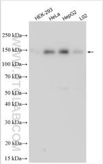 NCAPG2 Antibody in Western Blot (WB)