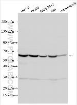 CCDC157 Antibody in Western Blot (WB)