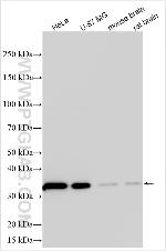 WNK3 Antibody in Western Blot (WB)