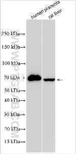TMEM38B Antibody in Western Blot (WB)