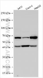 FAM161A Antibody in Western Blot (WB)