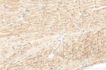 MYOM2 Antibody in Immunohistochemistry (Paraffin) (IHC (P))