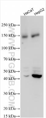 MYOM2 Antibody in Western Blot (WB)