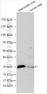 USP31 Antibody in Western Blot (WB)
