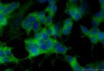 Proenkephalin-A Antibody in Immunocytochemistry (ICC/IF)