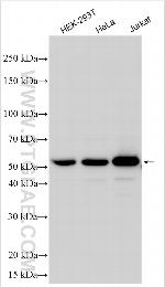 HLA-DQB1 Antibody in Western Blot (WB)