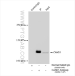 CAND1 Antibody in Immunoprecipitation (IP)
