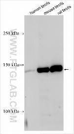 NRAMP1 Antibody in Western Blot (WB)