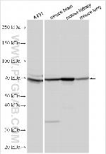 HEATR5B Antibody in Western Blot (WB)