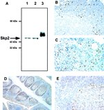 SKP2 Antibody in Western Blot, Immunohistochemistry (WB, IHC)