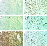 SKP2 Antibody in Immunohistochemistry (IHC)