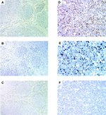 SKP2 Antibody in Immunohistochemistry (IHC)