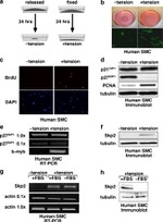 SKP2 Antibody in Western Blot (WB)
