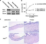 SKP2 Antibody in Western Blot (WB)