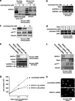 SKP2 Antibody in Western Blot (WB)