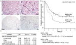 SKP2 Antibody in Immunohistochemistry (IHC)