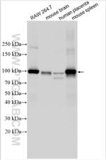 VE-cadherin/CD144 Antibody in Western Blot (WB)