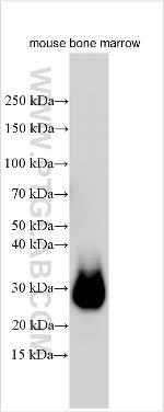 PDGFR beta Antibody in Western Blot (WB)