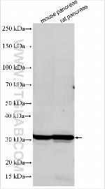 USP9Y Antibody in Western Blot (WB)