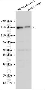 ELA3B Antibody in Western Blot (WB)