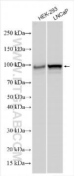 Transferrin Receptor 2/TFR2 Antibody in Western Blot (WB)