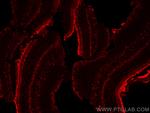 SLC7A11/xCT Antibody in Immunohistochemistry (Paraffin) (IHC (P))
