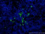 MPO Antibody in Immunohistochemistry (Paraffin) (IHC (P))