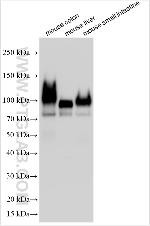 RBP4 Antibody in Western Blot (WB)