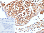 APC/Adenomatous Polyposis Coli/FAP (Tumor Suppressor) Recombinant Mouse Monoclonal Antibody (rEMM43)